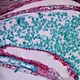 Trinocular Biological Microscope